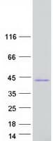 Human RRAD Protein (Recombinant Myc-DDK (Flag))