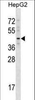 Polyclonal Rabbit anti-Human TBX20 Antibody (aa308-335, WB)