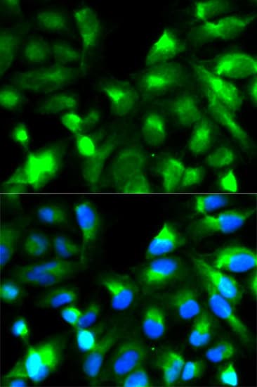 Polyclonal Rabbit anti-Human SNAP25 Antibody (IHC, IF, WB)