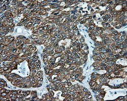 SRR / Serine Racemase Antibody (clone OTI2E3)
