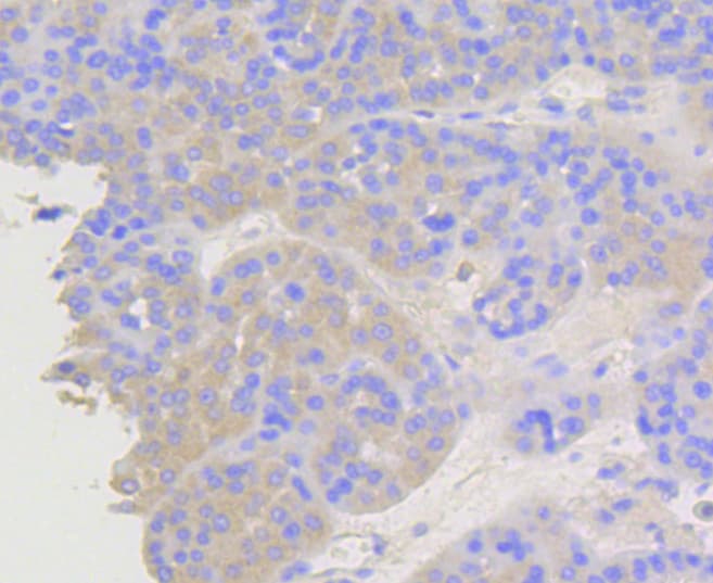 ARRB1 / Beta Arrestin 1 Antibody