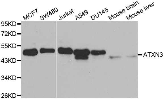Polyclonal Rabbit anti-Human ATXN3 / JOS Antibody (IHC, IF, WB)