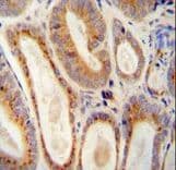 WFDC12 Antibody (aa66-94)