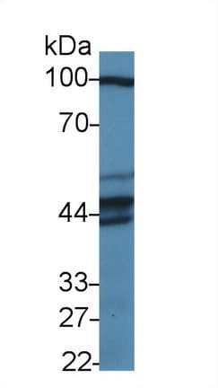 PUS1 Antibody (APC)