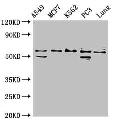 SERPING1 / C1 Inhibitor Antibody