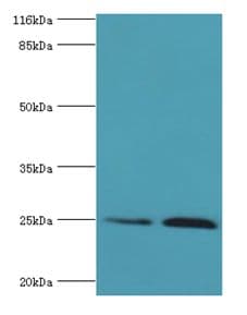 TK1 / TK / Thymidine Kinase Antibody (aa2-234)