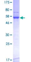 Human TOMM34 Protein (Recombinant GST)