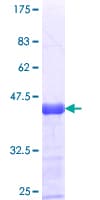 Human PNPLA6 / NTE Protein (Recombinant GST, N-terminus)
