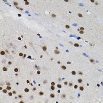 GTF2I / TFII I Antibody