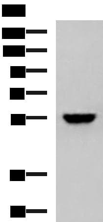 Polyclonal Rabbit anti-Human KPNA2 / Importin Alpha 1 Antibody (IHC, WB)