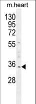 Polyclonal Rabbit anti-Human UP2 / UPP2 Antibody (aa217-244, IHC, WB)