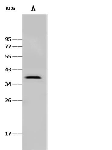 PDPN / Podoplanin Antibody (Preservative Free)