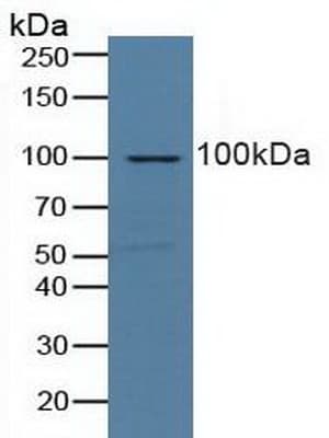 NCL / Nucleolin Antibody (aa388-569, Biotin)