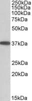 IHC-plus™ MOGAT2 Antibody (aa165-175)