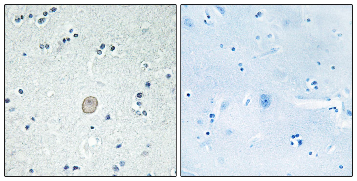 C3AR / C3a Receptor Antibody (aa175-224)