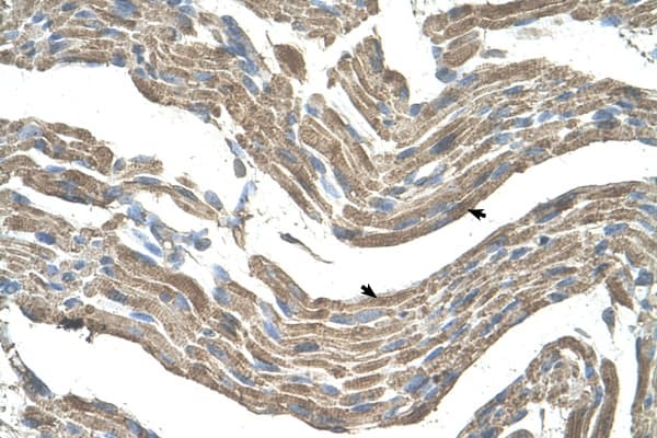 ASPN / Asporin Antibody (aa250-299)