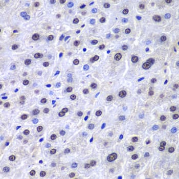 APEX1 / APE1 Antibody