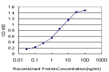 ACAN / Aggrecan Antibody (clone 2A8)