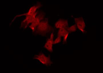 Polyclonal Rabbit anti-Human FAK / Focal Adhesion Kinase Antibody (phospho-Tyr925, IF, WB)