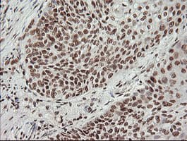 MCTS1 Antibody (aa1-181, clone OTI2F9)