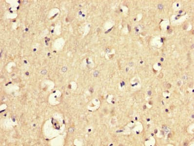 Polyclonal Rabbit anti-Human MGP / Matrix Gla-Protein Antibody (aa20-96)