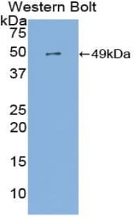 FGG / Fibrinogen Gamma Antibody (aa27-435)