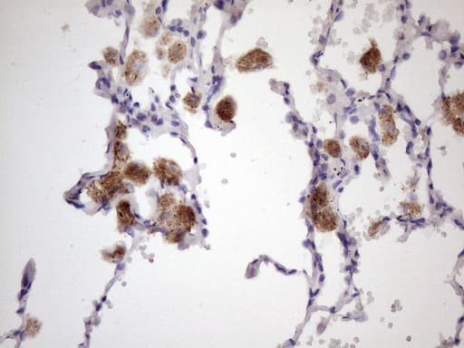 ALOX12 / 12 Lipoxygenase Antibody (clone OTI1C3)