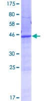 Human ANKRD22 Protein (Recombinant GST)