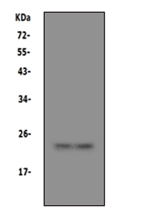 PRNP / PrP / Prion Antibody (aa144-160)