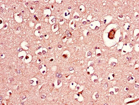 AGK Antibody