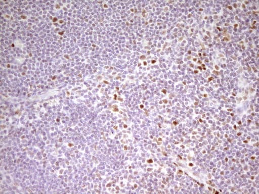 MEF2D Antibody (aa1-282, clone OTI1E11, Carrier-free)