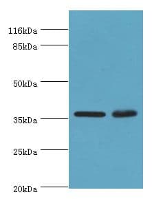 ACKR1 / DARC Antibody (aa1-63)