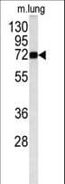 MAOB / Monoamine Oxidase B Antibody (aa303-334)