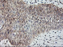 Monoclonal Mouse anti-Human MTFMT Antibody (clone OTI1E7, aa175-389, IHC, WB)
