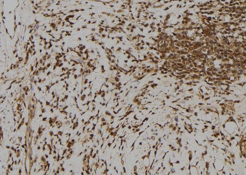 RFPL1 Antibody