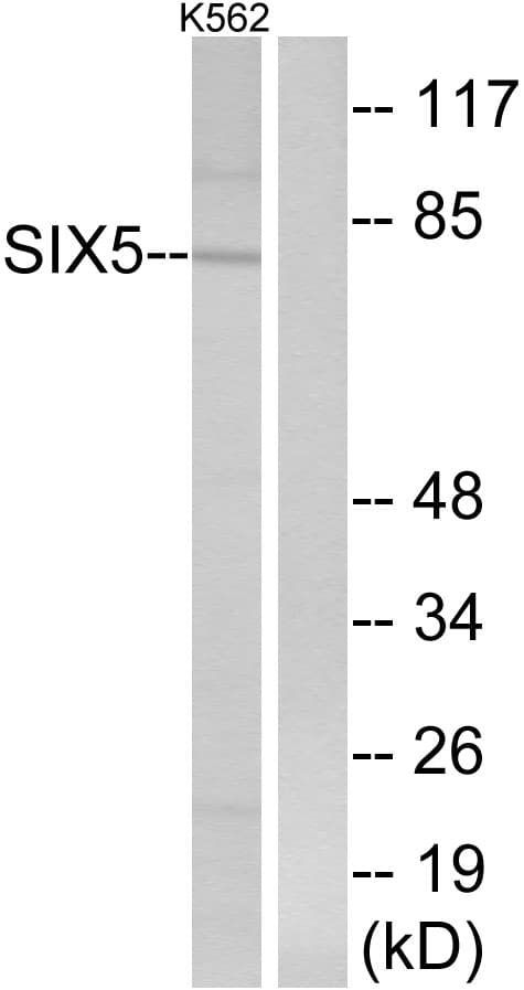 Polyclonal Rabbit anti-Human SIX5 Antibody (aa201-250, WB)