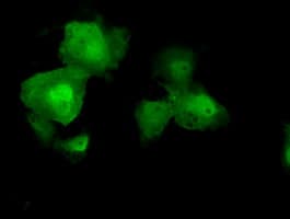 AKT2 Antibody (clone OTI4H7)