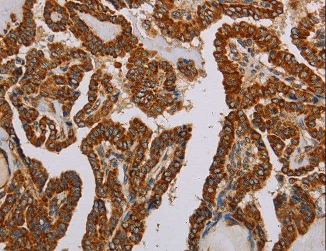 NDUFS5 Antibody