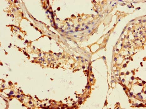 EPHB2 / EPH Receptor B2 Antibody