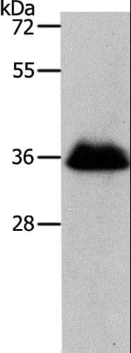 RNF126 Antibody