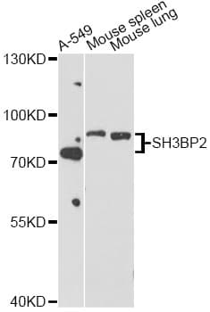 SH3BP2 Antibody