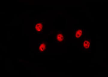 MED18 Antibody
