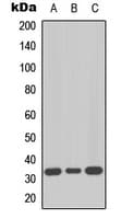 NIFK / MKI67IP Antibody (Internal)
