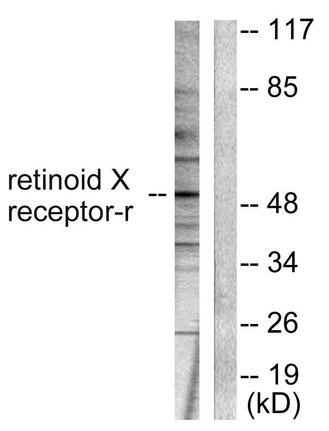RXRG Antibody (aa171-220)
