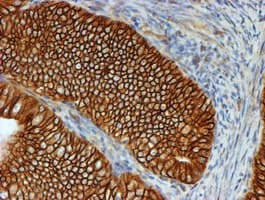 CTNNB1 / Beta Catenin Antibody (clone OTI3F9)