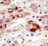 PIK3C3 / VPS34 Antibody (aa24-53)