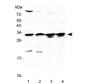 RPS6 / Ribosomal Protein S6 Antibody