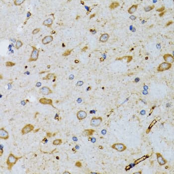 SRP19 Antibody