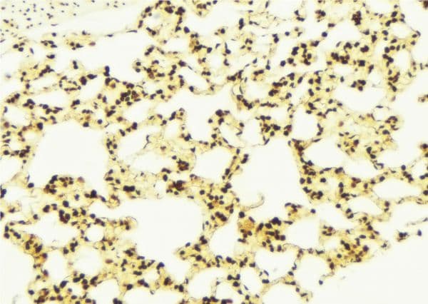 Polyclonal Rabbit anti-Human IL15 Antibody (IHC, WB)