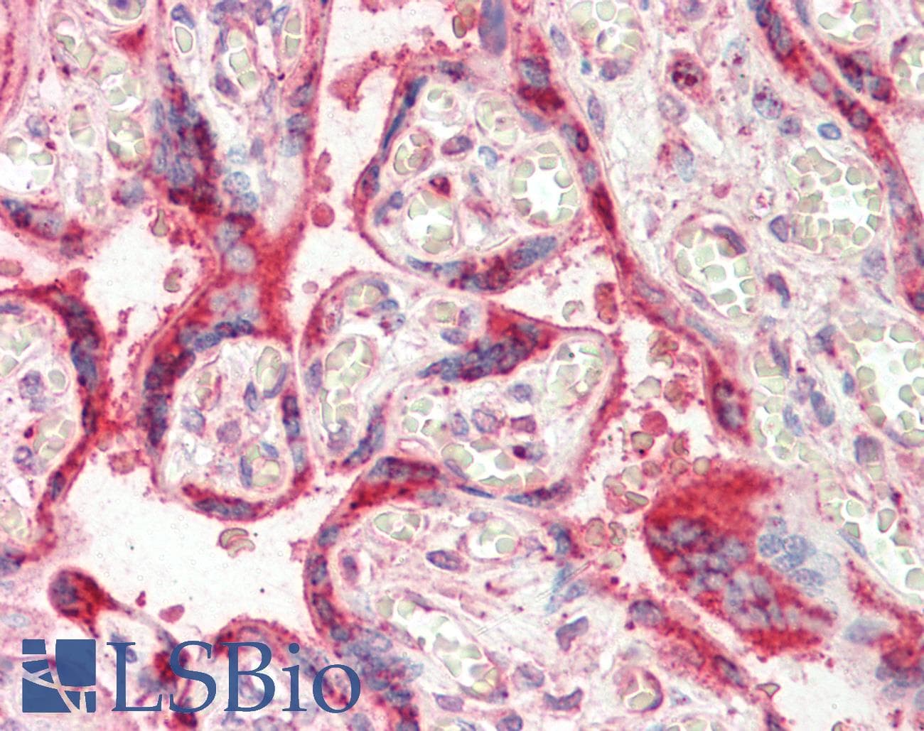 IHC-plus™ HSPA5 / GRP78 / BiP Antibody (aa645-654)